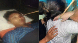 Foto Kolase – Seorang pemuda di Tallo tertembus busur panah di mata, sementara seorang perempuan muda juga menjadi korban busur panah di leher belakang.