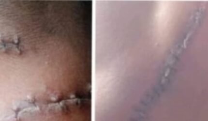 Korban Sebut Ada Dalang di Balik Pembacokan Brutal di Polsek Polut