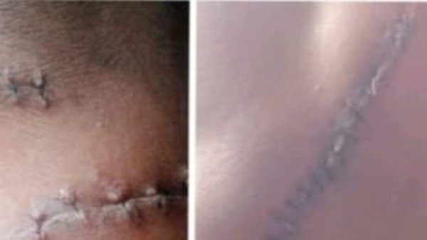 foto slider headline