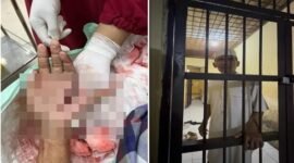 Foto close-up penanganan medis pada luka tebas serius di telapak tangan kiri Hz. Di sebelah kanan, foto menunjukkan Hz, seorang tokoh masyarakat dengan kemeja dan peci putih, berdiri di dalam sel tahanan Polsek. (Kolase)