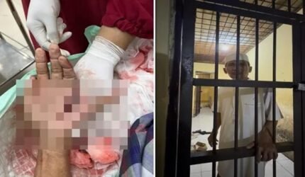 Pilu Tokoh Warga Jeneponto, Tangan Hampir Putus Usai Tegur Prostitusi Kini Dipenjara